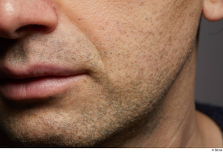 HD Face skin references Josh Hart cheek lips mouth skin…